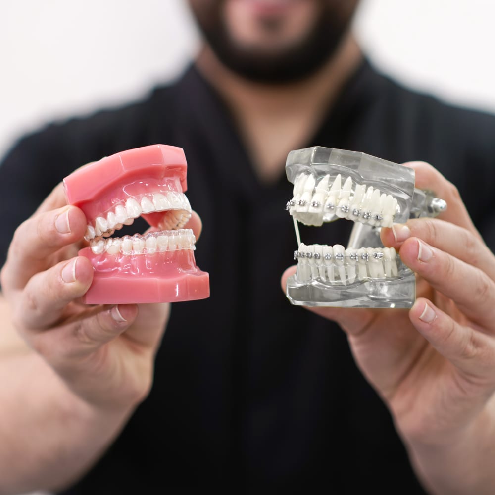 Man holding a clear dental model of teeth and gums wearing braces in his left hand and a natural coloured dental model of teeth and gums wearing clear aligners in his right hand.
